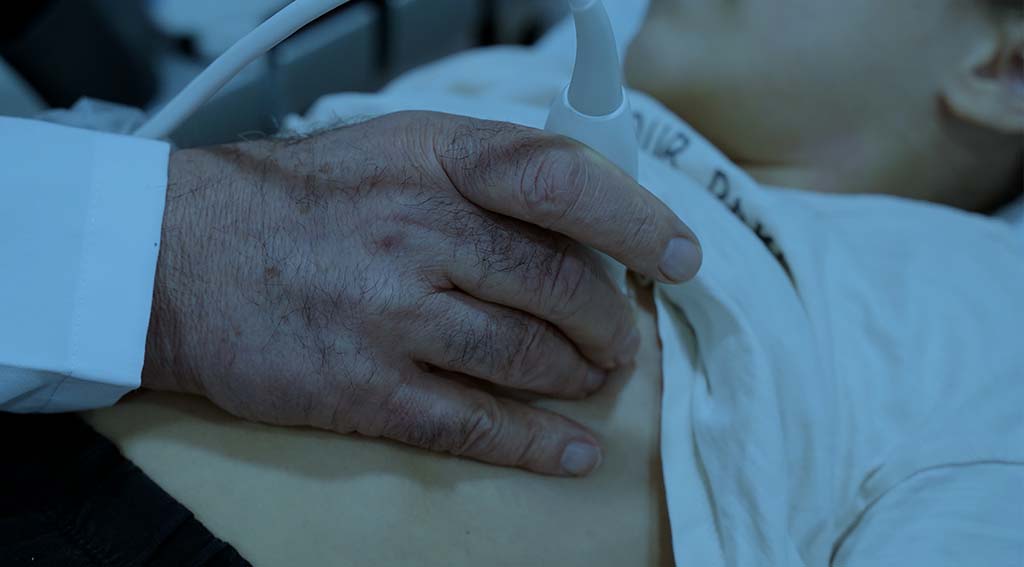 Akut Romatizmal Ateş